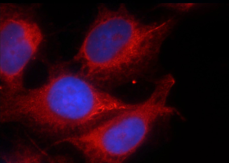 Immunofluorescent analysis of HUVEC cells using Catalog No:114203(PRKG2 Antibody) at dilution of 1:25 and Rhodamine-Goat anti-Rabbit IgG