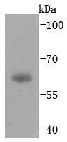 Fig1:; Western blot analysis of IgA on human plasma lysates. Proteins were transferred to a PVDF membrane and blocked with 5% BSA in PBS for 1 hour at room temperature. The primary antibody ( 1/500) was used in 5% BSA at room temperature for 2 hours. Goat Anti-Rabbit IgG - HRP Secondary Antibody (HA1001) at 1:5,000 dilution was used for 1 hour at room temperature.