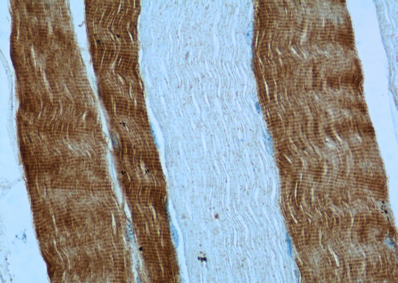 Immunohistochemistry of paraffin-embedded human skeletal muscle tissue slide using Catalog No:116149(TNNC2 Antibody) at dilution of 1:50 (under 40x lens)