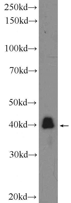 Raji cells were subjected to SDS PAGE followed by western blot with Catalog No:109117(CDCA7 Antibody) at dilution of 1:200