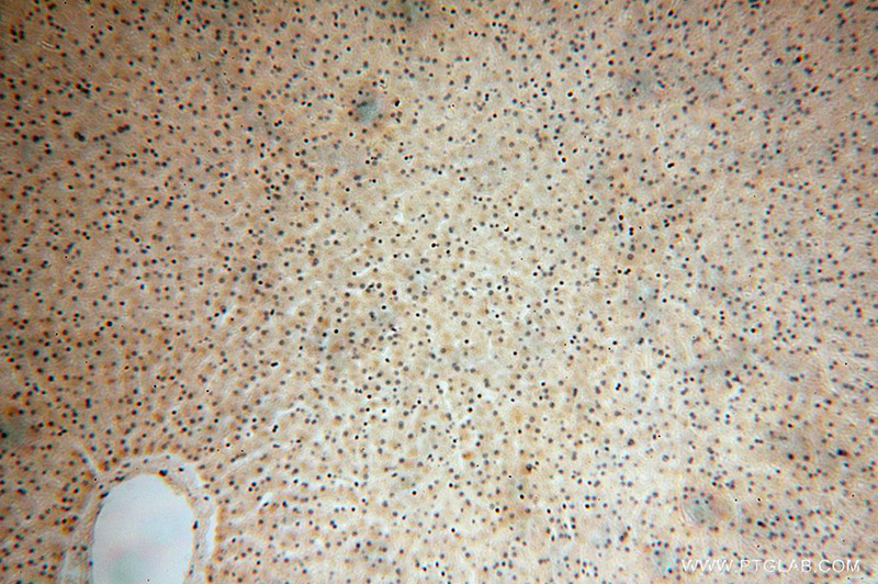 Immunohistochemical of paraffin-embedded human liver using Catalog No:116550(UFC1 antibody) at dilution of 1:100 (under 10x lens)