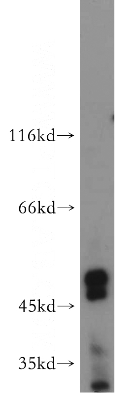 MCF7 cells were subjected to SDS PAGE followed by western blot with Catalog No:107994(AMIGO3 antibody) at dilution of 1:300