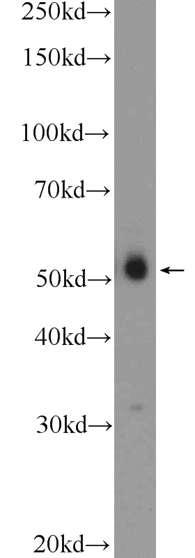 HeLa cells were subjected to SDS PAGE followed by western blot with Catalog No:110544(FBXL16 Antibody) at dilution of 1:600