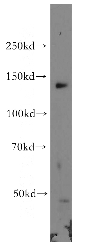 A431 cells were subjected to SDS PAGE followed by western blot with Catalog No:114039(POLR2B-Specific antibody) at dilution of 1:500