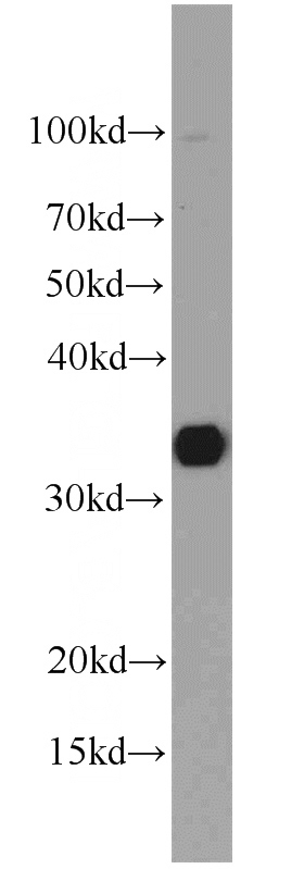 mouse liver tissue were subjected to SDS PAGE followed by western blot with Catalog No:115825(SULT1A1 antibody) at dilution of 1:1000