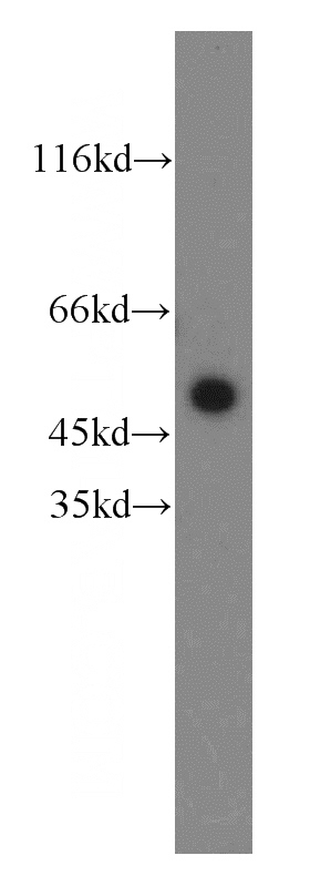 HeLa cells were subjected to SDS PAGE followed by western blot with Catalog No:110776(FRK antibody) at dilution of 1:800