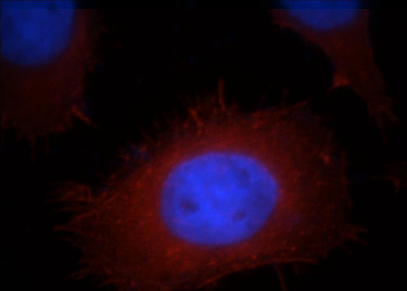 Immunofluorescent analysis of MCF-7 cells, using ACTN4 antibody Catalog No:107712 at 1:25 dilution and Rhodamine-labeled goat anti-rabbit IgG (red). Blue pseudocolor = DAPI (fluorescent DNA dye).