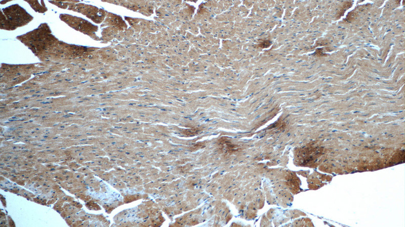 Immunohistochemistry of paraffin-embedded mouse heart tissue slide using Catalog No:112936(MYH7 Antibody) at dilution of 1:50 (under 10x lens)
