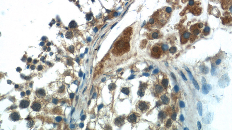 Immunohistochemistry of paraffin-embedded human testis tissue slide using Catalog No:111562(HSFY1 Antibody) at dilution of 1:50 (under 40x lens)