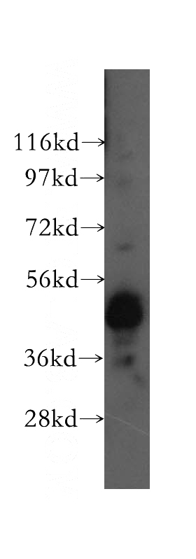 Y79 cells were subjected to SDS PAGE followed by western blot with Catalog No:113607(PAX6 antibody) at dilution of 1:500