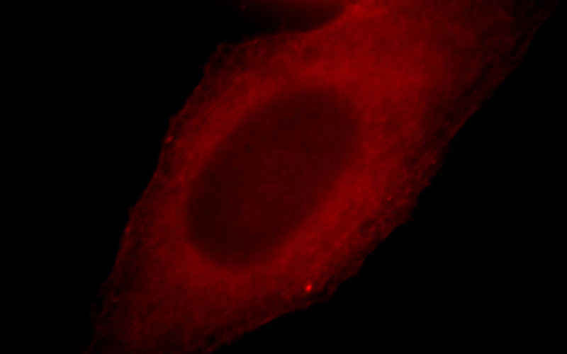 Immunofluorescent analysis of HepG2 cells, using LRMP antibody Catalog No:112319 at 1:25 dilution and Rhodamine-labeled goat anti-rabbit IgG (red).