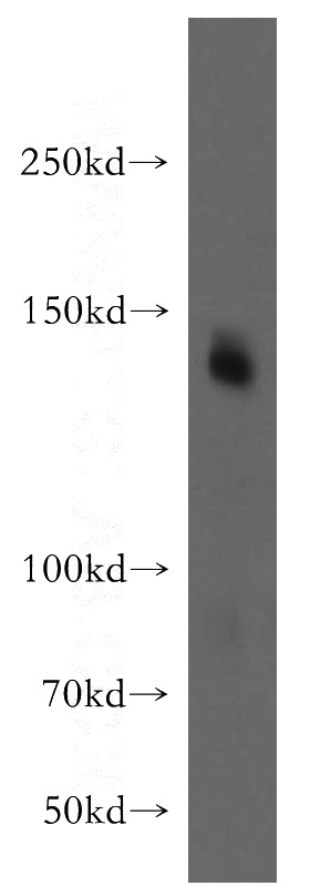 mouse brain tissue were subjected to SDS PAGE followed by western blot with Catalog No:111592(ICAM5 antibody) at dilution of 1:800