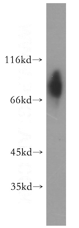 human placenta tissue were subjected to SDS PAGE followed by western blot with Catalog No:111097(GMEB2 antibody) at dilution of 1:300