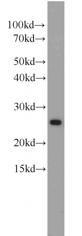 COLO 320 cells were subjected to SDS PAGE followed by western blot with Catalog No:114517(Rad51D antibody) at dilution of 1:1000