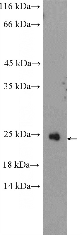 Jurkat cells were subjected to SDS PAGE followed by western blot with Catalog No:114486(RAX2 Antibody) at dilution of 1:300