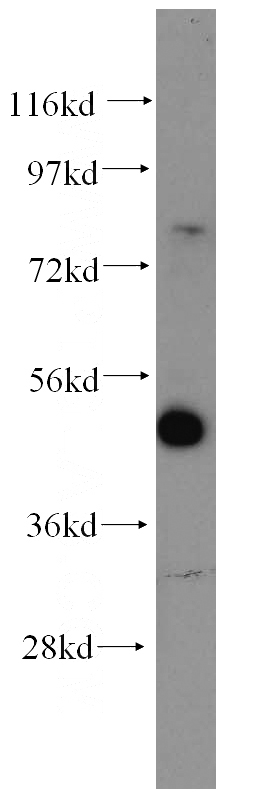 HeLa cells were subjected to SDS PAGE followed by western blot with Catalog No:112176(LCOR antibody) at dilution of 1:300