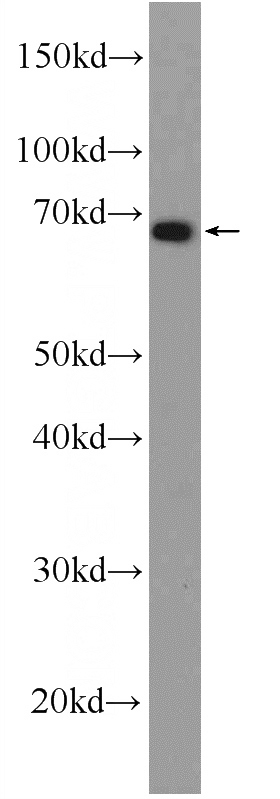 mouse liver tissue were subjected to SDS PAGE followed by western blot with Catalog No:110006(DMRTA1 Antibody) at dilution of 1:600