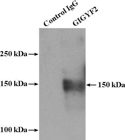 IP Result of anti-GIGYF2 (IP:Catalog No:110970, 4ug; Detection:Catalog No:110970 1:2000) with Jurkat cells lysate 2000ug.