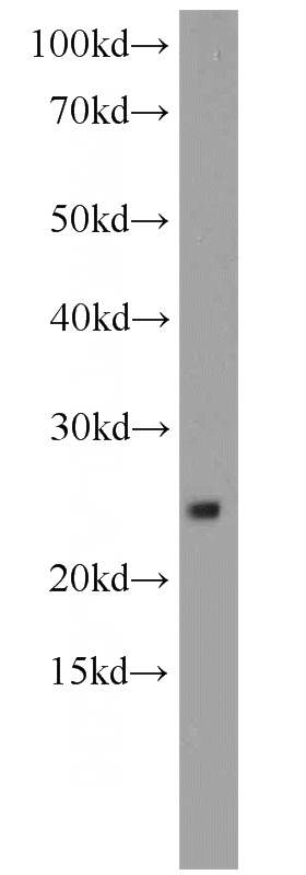 mouse uterus tissue were subjected to SDS PAGE followed by western blot with Catalog No:114917(RPS9 antibody) at dilution of 1:500