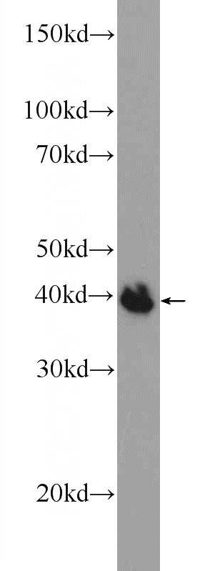 fetal human brain tissue were subjected to SDS PAGE followed by western blot with Catalog No:114072(POU3F4 Antibody) at dilution of 1:300