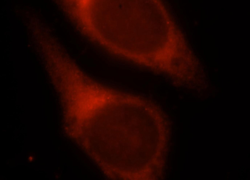 Immunofluorescent analysis of HepG2 cells, using TIMP2 antibody Catalog No:116140 at 1:25 dilution and Rhodamine-labeled goat anti-rabbit IgG (red).