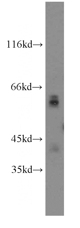A549 cells were subjected to SDS PAGE followed by western blot with Catalog No:111090(GPC4 antibody) at dilution of 1:200
