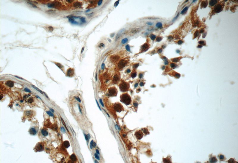 Immunohistochemistry of paraffin-embedded human testis tissue slide using Catalog No:112897(MUM1L1 Antibody) at dilution of 1:50 (under 40x lens)
