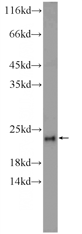 HeLa cells were subjected to SDS PAGE followed by western blot with Catalog No:109762(DCTPP1 Antibody) at dilution of 1:300