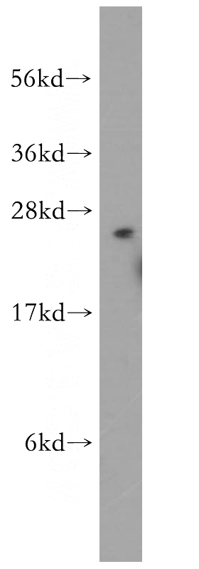 HeLa cells were subjected to SDS PAGE followed by western blot with Catalog No:110674(FKBP3 antibody) at dilution of 1:500
