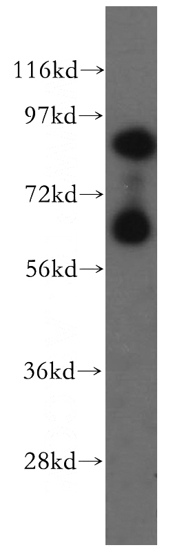 HEK-293 cells were subjected to SDS PAGE followed by western blot with Catalog No:115858(TAX1BP1 antibody) at dilution of 1:500