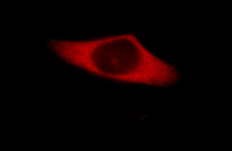 Immunofluorescent analysis of Hela cells, using INVS antibody Catalog No:111814 at 1:25 dilution and Rhodamine-labeled goat anti-rabbit IgG (red).
