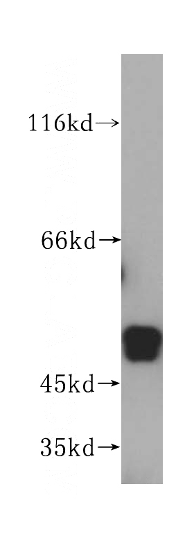 HeLa cells were subjected to SDS PAGE followed by western blot with Catalog No:112946(NAP1L4 antibody) at dilution of 1:1000