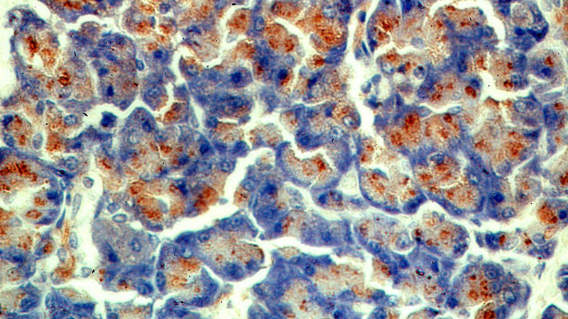 Immunohistochemical of paraffin-embedded human pancreas using Catalog No:109306(CTRL antibody) at dilution of 1:100 (under 40x lens)