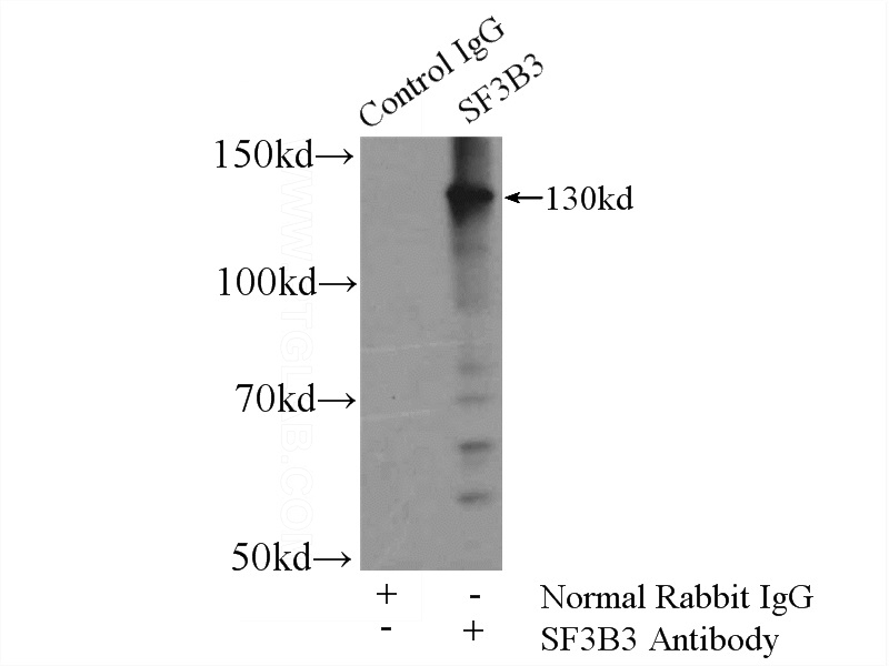 IP Result of anti-SF3B3 (IP:Catalog No:115138, 4ug; Detection:Catalog No:115138 1:5000) with rat brain tissue lysate 4800ug.