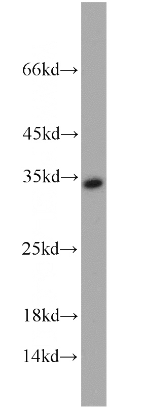 A549 cells were subjected to SDS PAGE followed by western blot with Catalog No:114794(RPA2 antibody) at dilution of 1:1000