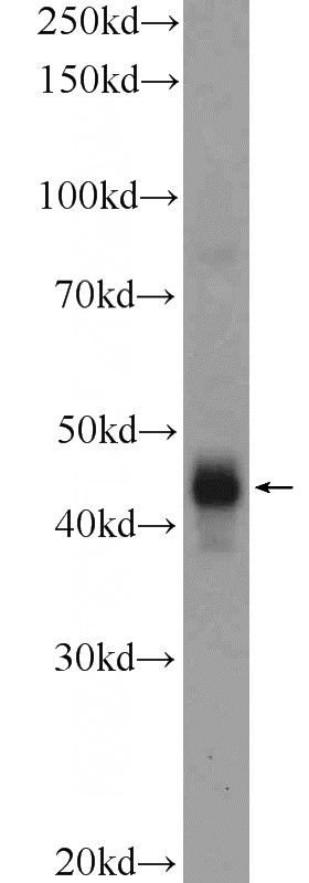 human placenta tissue were subjected to SDS PAGE followed by western blot with Catalog No:109007(CD209 Antibody) at dilution of 1:1200