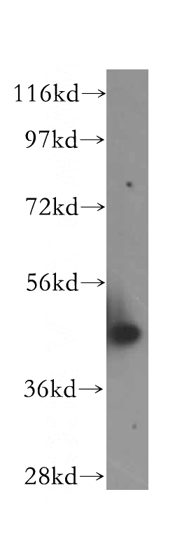 HeLa cells were subjected to SDS PAGE followed by western blot with Catalog No:113454(NXN antibody) at dilution of 1:400