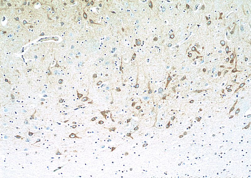 Immunohistochemistry of paraffin-embedded human brain tissue slide using Catalog No:115008(SCN9A-Specific Antibody) at dilution of 1:200 (under 10x lens)