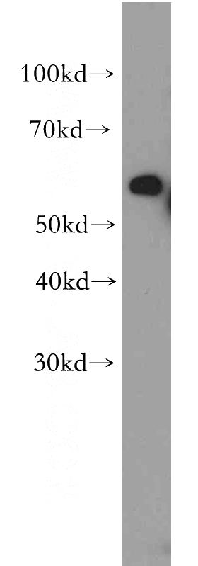 human heart tissue were subjected to SDS PAGE followed by western blot with Catalog No:113151(NFIB antibody) at dilution of 1:500