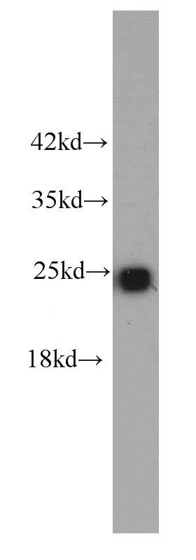 HeLa cells were subjected to SDS PAGE followed by western blot with Catalog No:107225(PPIB antibody) at dilution of 1:1000