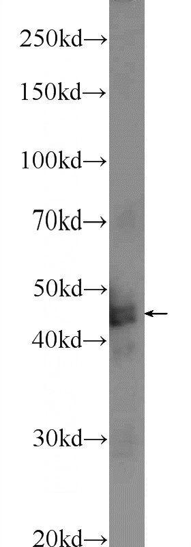 mouse brain tissue were subjected to SDS PAGE followed by western blot with Catalog No:116175(TMEM201 Antibody) at dilution of 1:100
