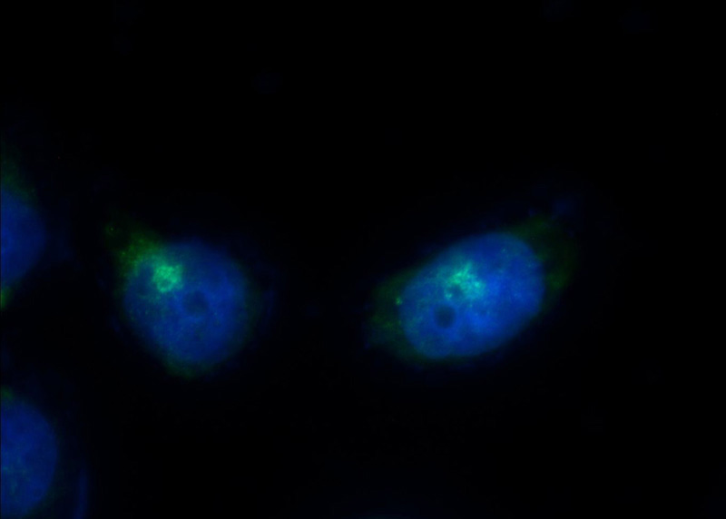 Immunofluorescent analysis of HeLa cells using Catalog No:114572(EBAG9 Antibody) at dilution of 1:25 and Alexa Fluor 488-congugated AffiniPure Goat Anti-Rabbit IgG(H+L)