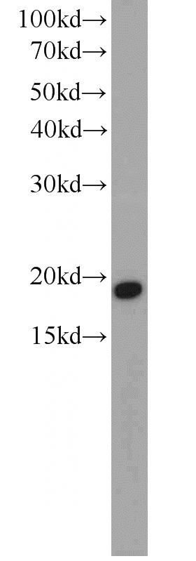 Jurkat cells were subjected to SDS PAGE followed by western blot with Catalog No:109202(CGGBP1 antibody) at dilution of 1:1000