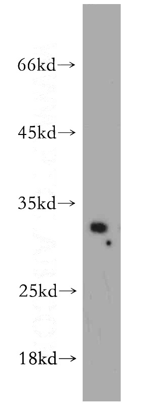 mouse liver tissue were subjected to SDS PAGE followed by western blot with Catalog No:115568(SPI1 antibody) at dilution of 1:300