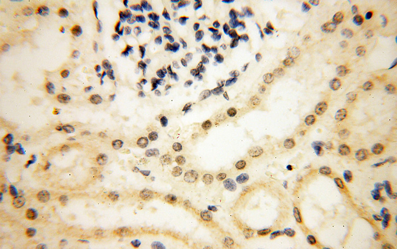 Immunohistochemical of paraffin-embedded human kidney using Catalog No:115432(SMARCC1 antibody) at dilution of 1:100 (under 40x lens)