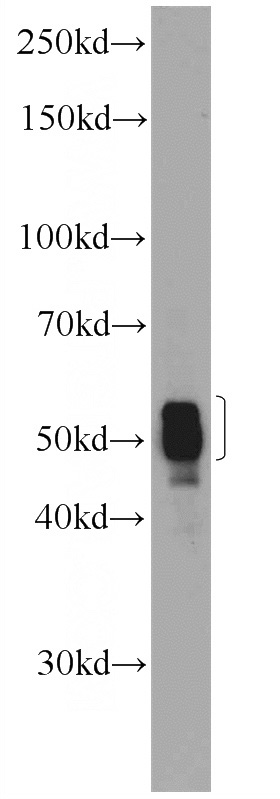 PC-3 cells were subjected to SDS PAGE followed by western blot with Catalog No:109307(CIAO1 Antibody) at dilution of 1:600