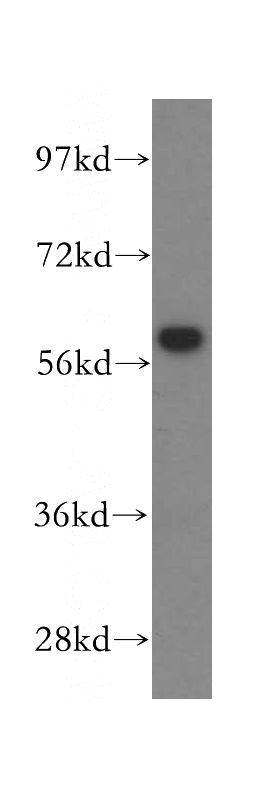 HeLa cells were subjected to SDS PAGE followed by western blot with Catalog No:109036(CCT7 antibody) at dilution of 1:500
