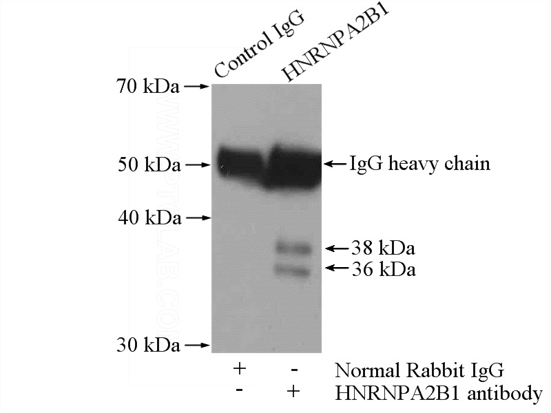 IP Result of anti-HNRNPA2B1 (IP:Catalog No:111501, 4ug; Detection:Catalog No:111501 1:500) with mouse liver tissue lysate 4000ug.