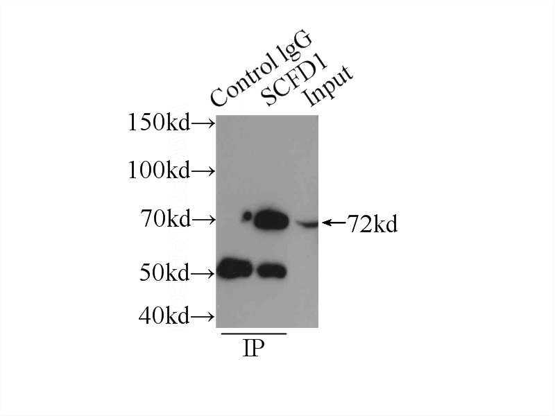 IP Result of anti-SCFD1 (IP:Catalog No:114991, 3ug; Detection:Catalog No:114991 1:500) with HeLa cells lysate 2150ug.
