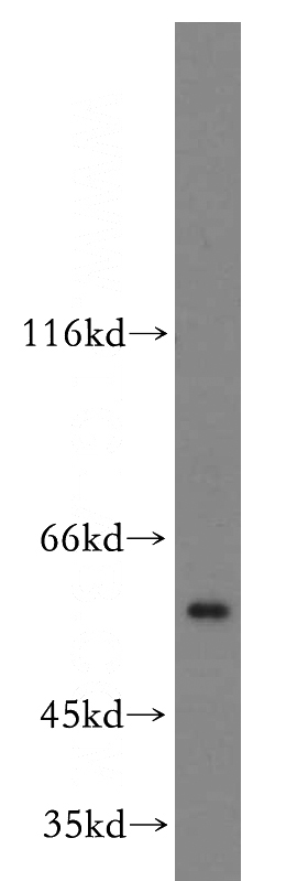 mouse testis tissue were subjected to SDS PAGE followed by western blot with Catalog No:108297(ATG4C antibody) at dilution of 1:500